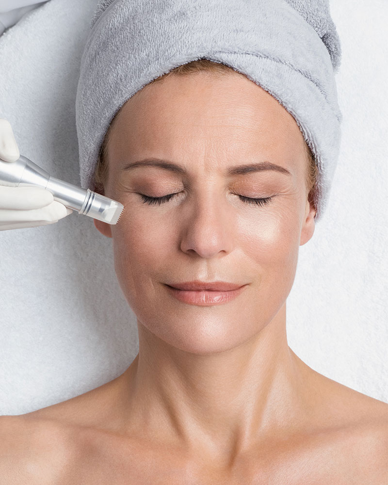 REVIDERM Skin Needler Behandlung im Studio Mirabilis Beauty